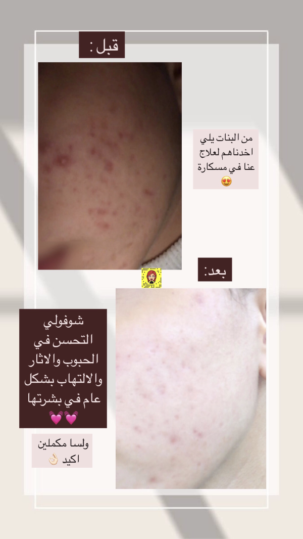 عبير من قفين 💓