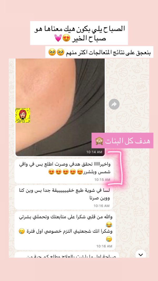 يقين من قلقيلية 💓