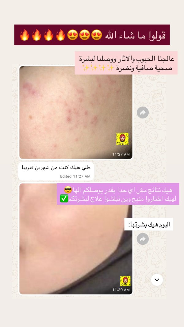 منال من طولكرم💓